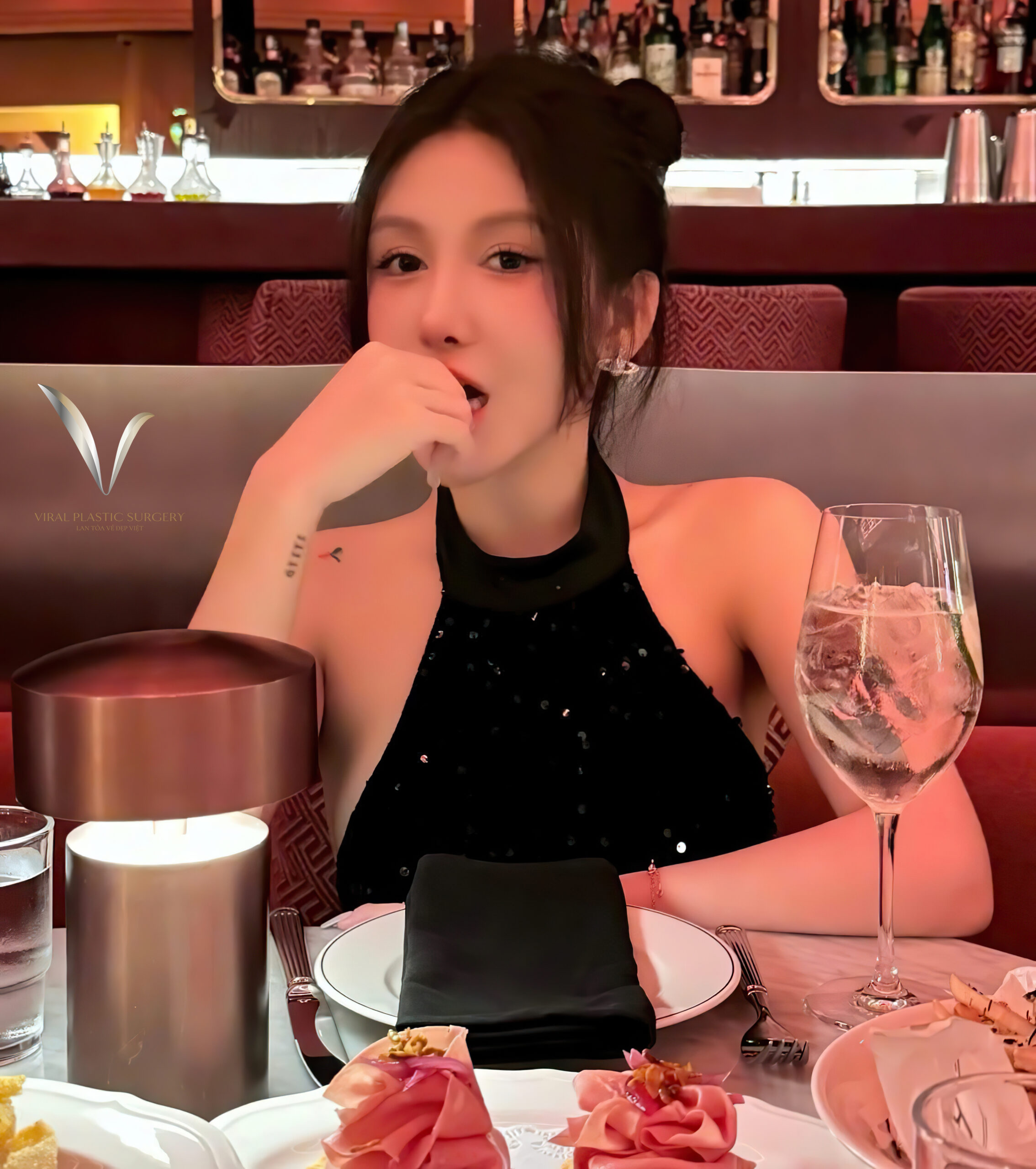 Nâng mũi đẹp