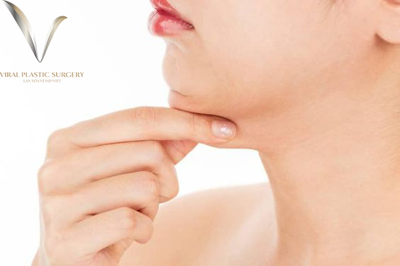 nọng mỡ cằm là gì?